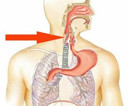 Hướng dẫn bệnh nhân sau mổ cắt thực quản điều trị ung thư thực quản